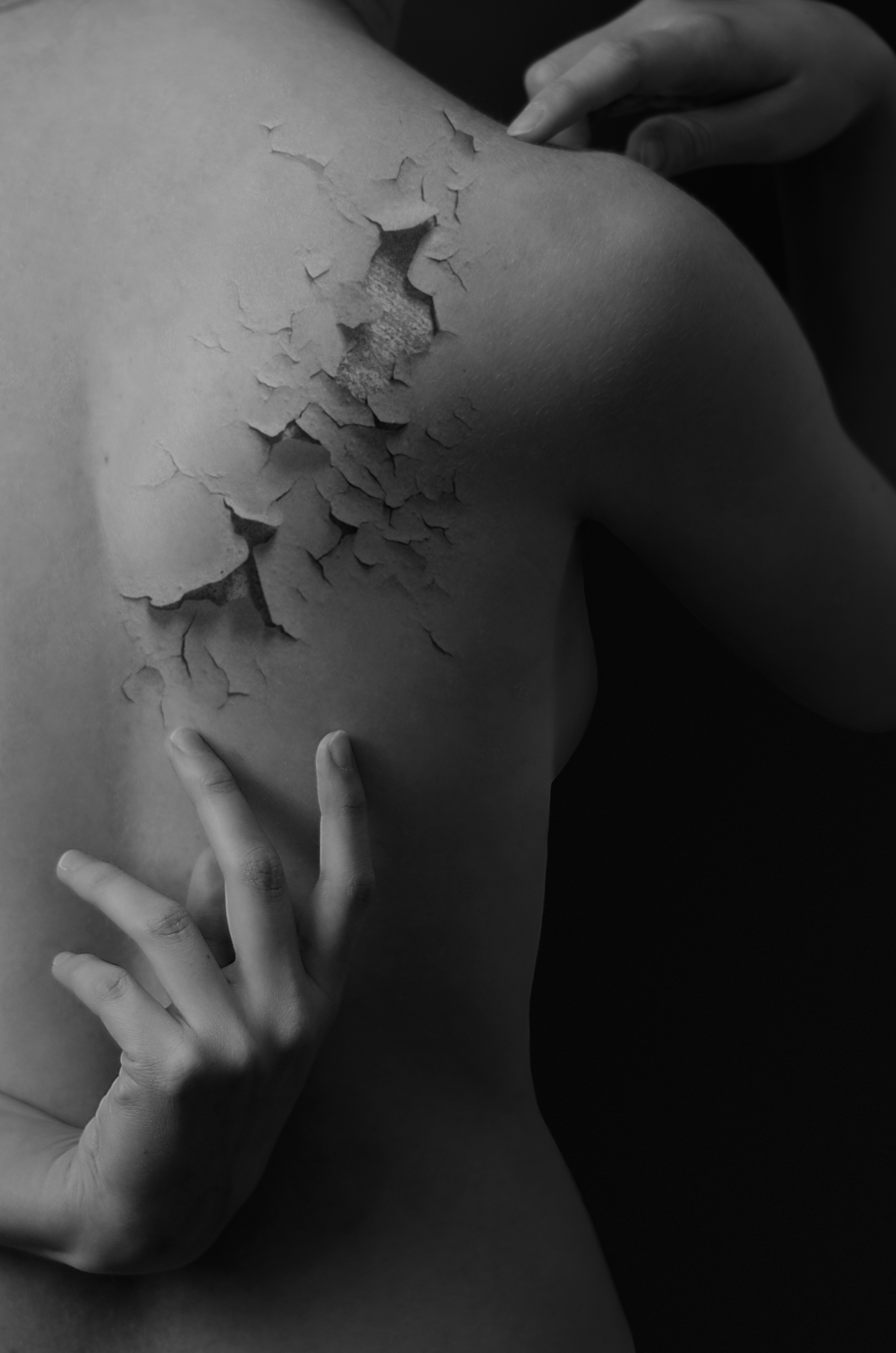 Dermatillomania Series – Broken Light Collective